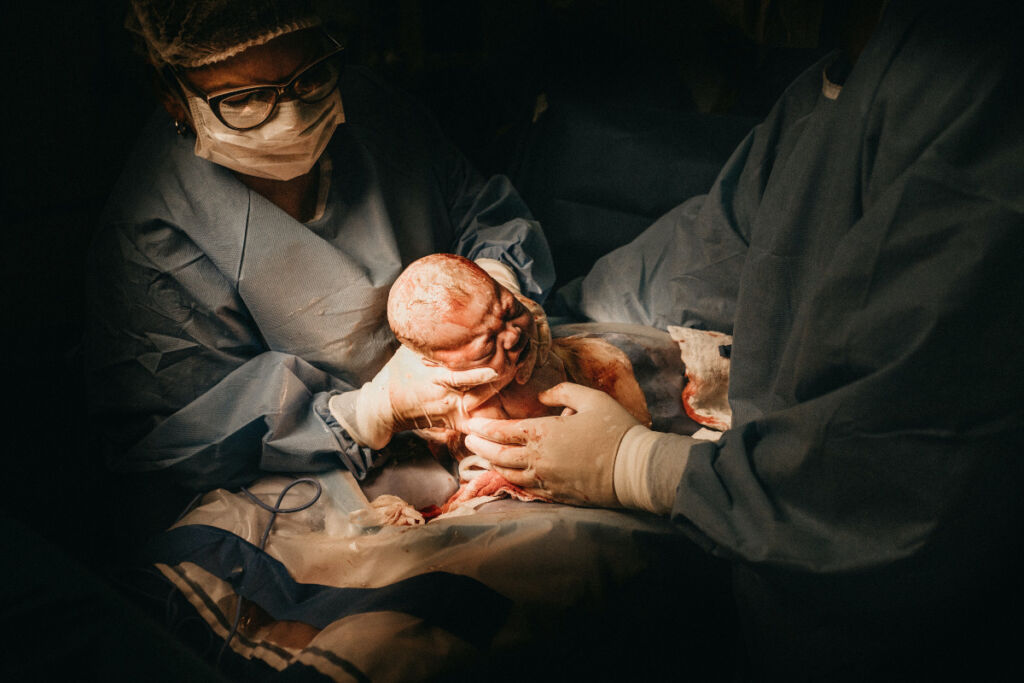 Para o bebê, o parto normal traz inúmeros benefícios também e pode evitar problemas de saúde futuros. Na imagem, bebê nasce via cirurgia cesariana - Foto: Jonathan Borba/Pexels